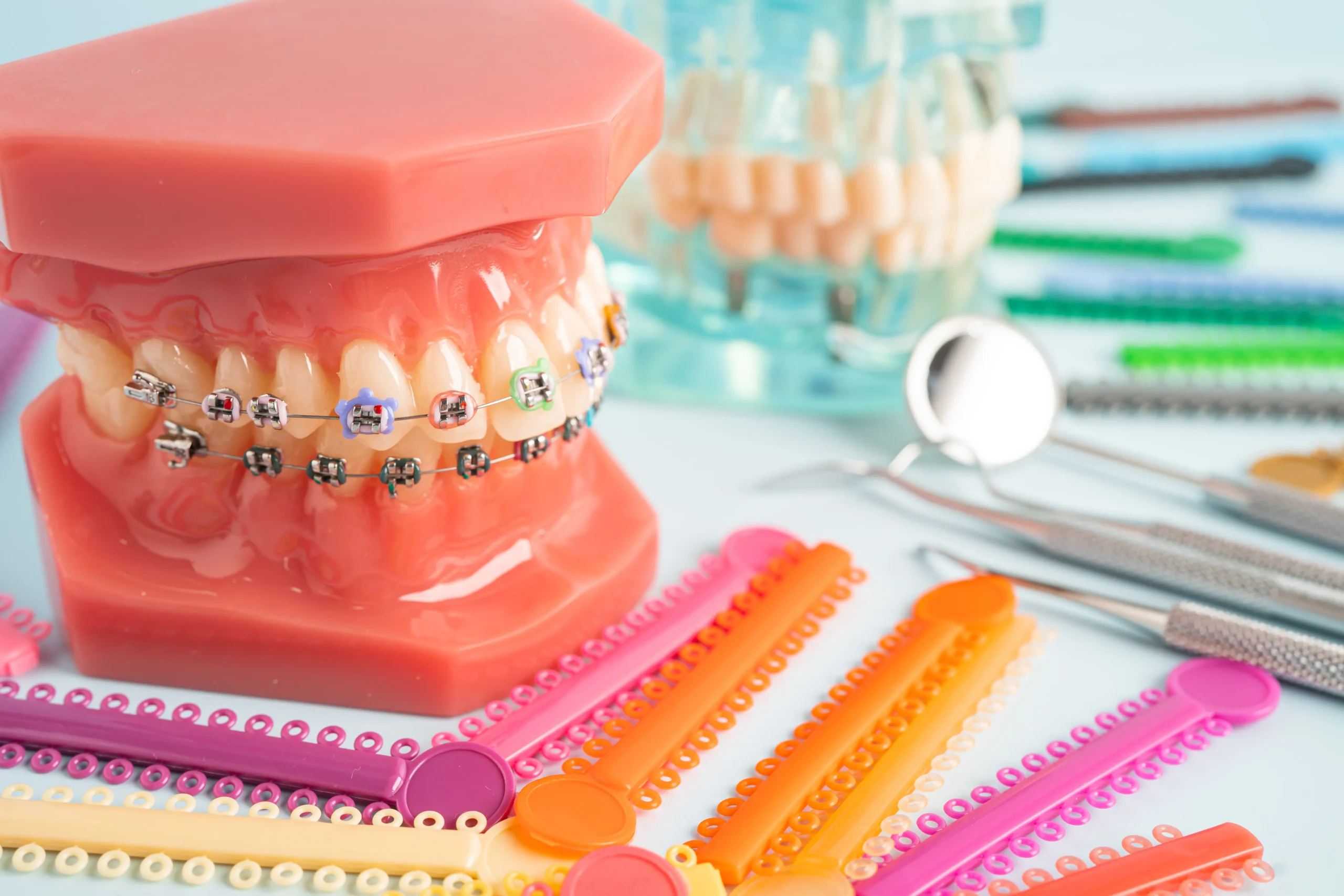 does braces hurt types of braces klinik pergigian prima senawang