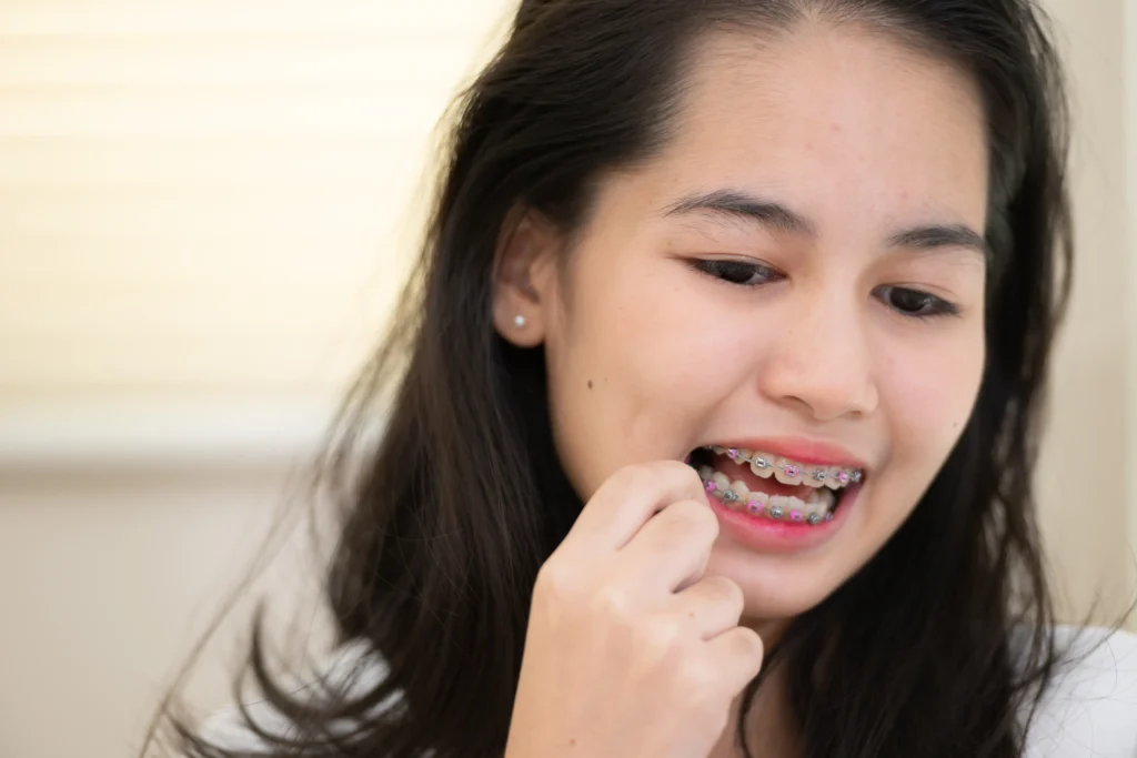 Choosing the Right Food for Braces in Malaysia 5 food for braces woman with braces klinik pergigian prima senawang